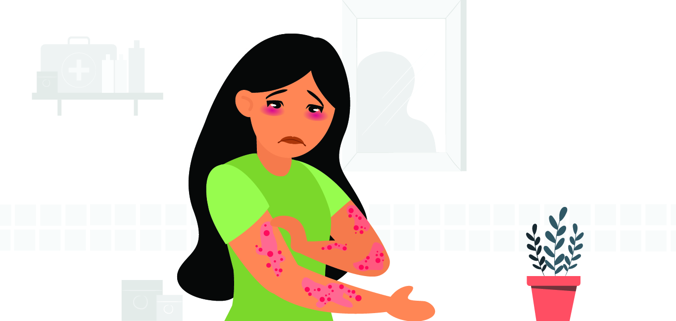 Eczema Causes, Diagnosis, Treatment Happiest Health