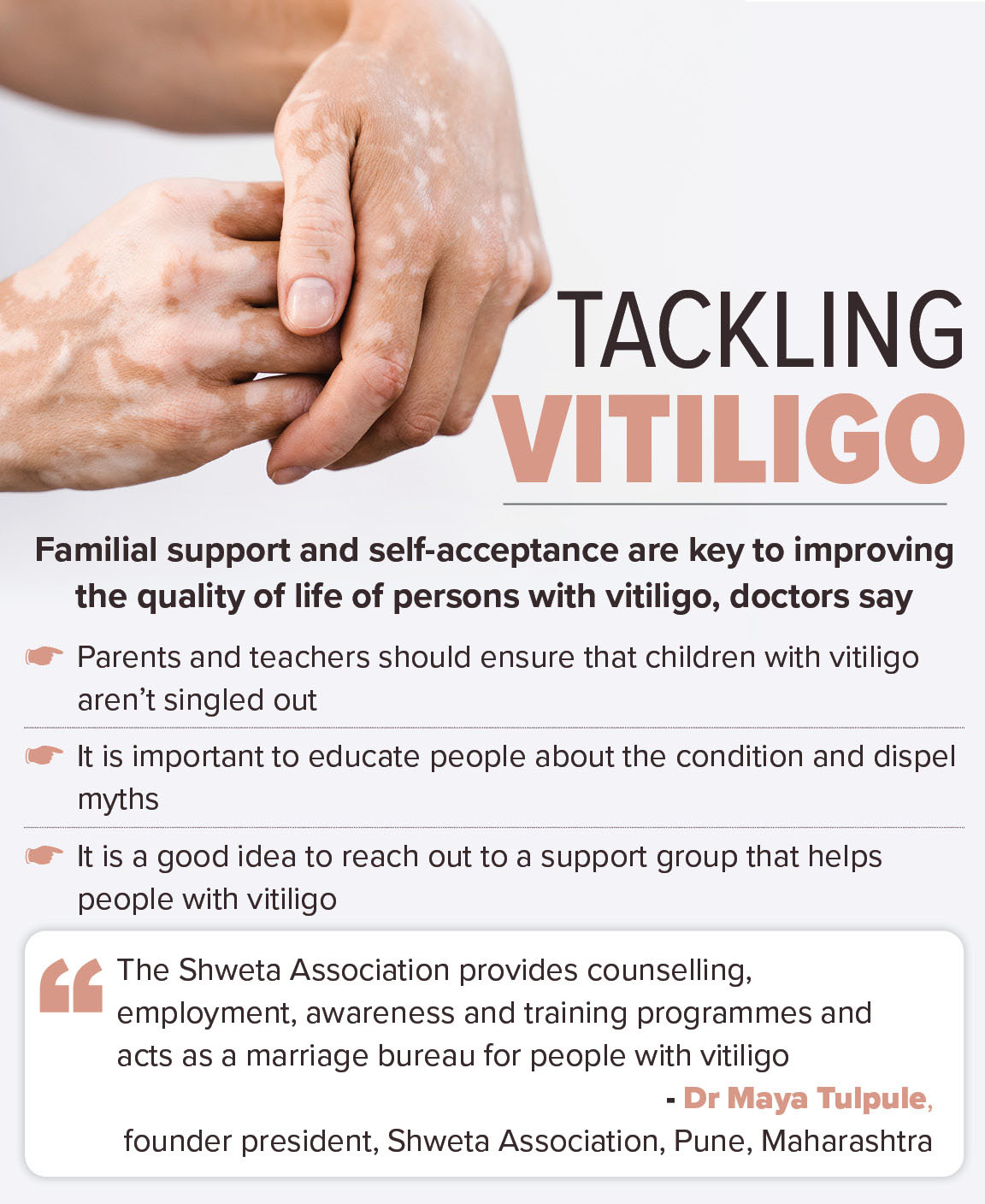 vitiligo